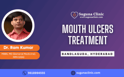 Best Mouth ulcers Treatment Clinic in Bandlaguda, Hyderabad